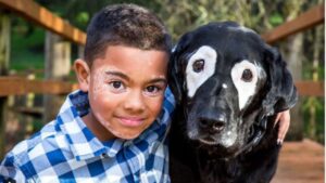 La vitiligine fa nascere una amicizia speciale tra questo bambino e un cane