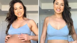 Il prima e il dopo di un parto gemellare: le foto della donna diventano virali